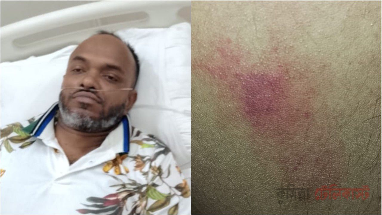 কুমিল্লায় সাংবাদিককে অপহরণের চেষ্টা, টাকা ও মোবাইল ছিনতাইয়ের অভিযোগ